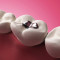 Entgiftungs- und Ausleittherapien / EDTA-Chelat-Therapie